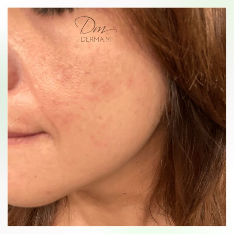 278867022_995404978035705_3837102210209778794_n