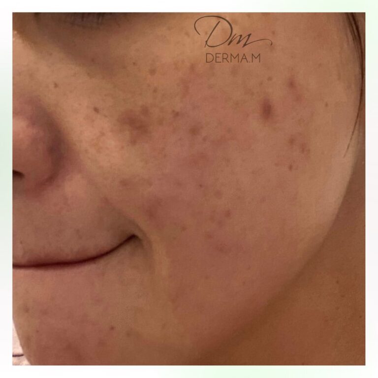 278991372_1137249710429141_8745154006508494954_n