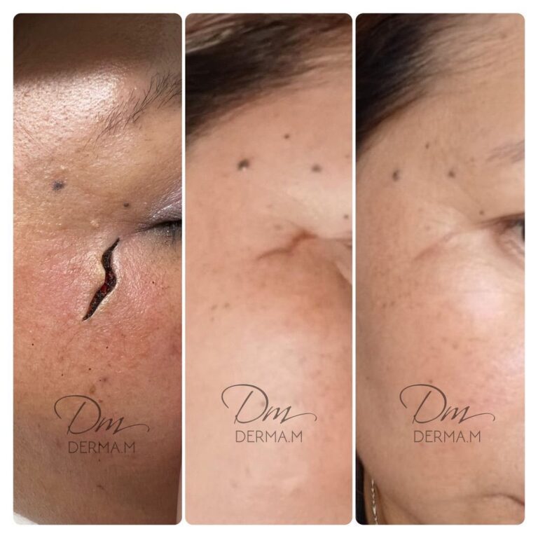 318754998_186420524051195_3109426310763664940_n