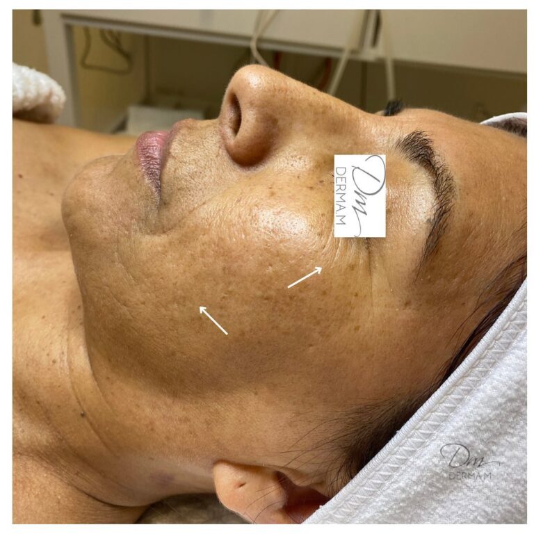 324070843_856578762121574_2667392500456844004_n