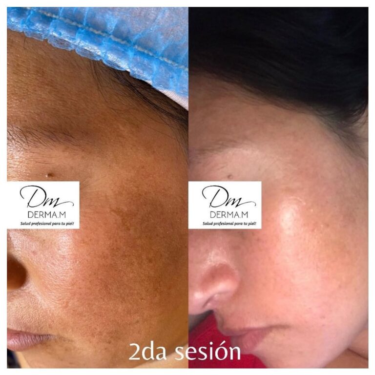 331466060_131226559611549_1293983855634229305_n