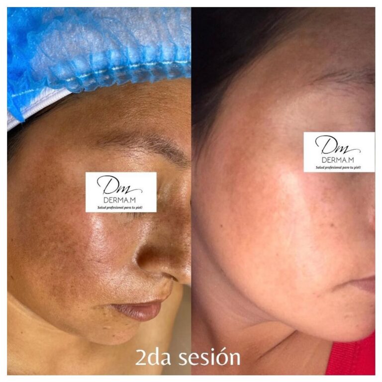 331936718_574143224772973_3487724236059467446_n