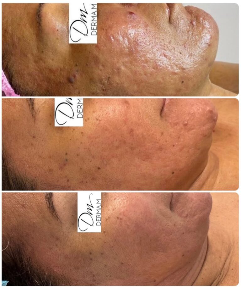 347404928_17961038495607504_5492109983659660889_n