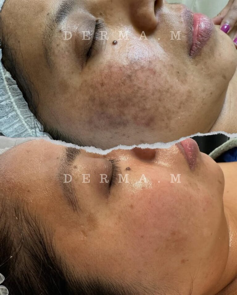 468297079_18027510380607504_4988488564557829990_n