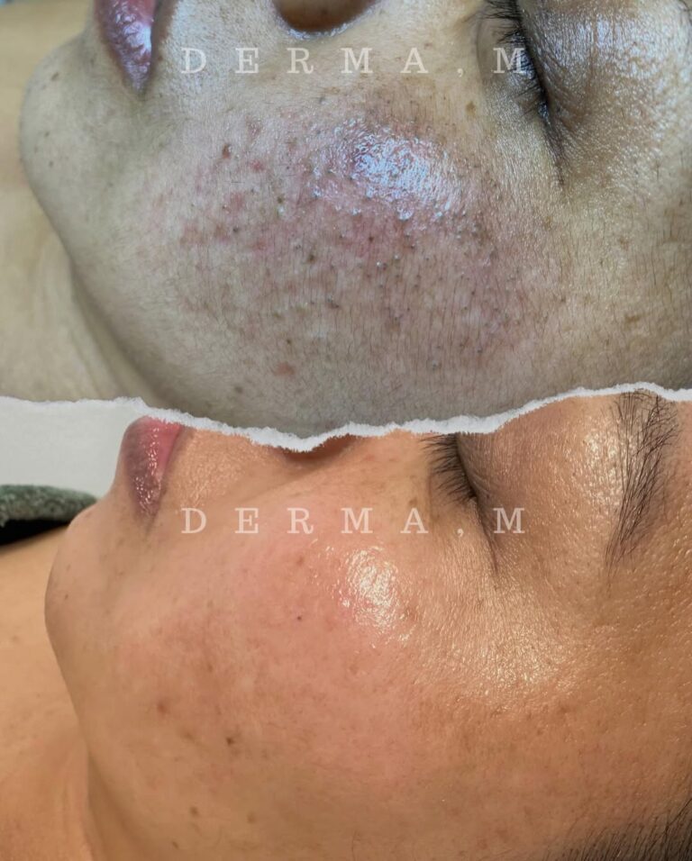 468406542_18027510371607504_5168572054947851140_n