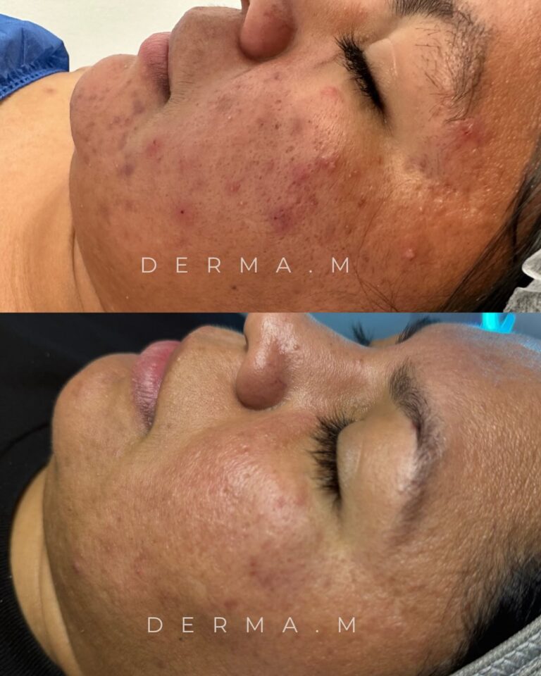 485841082_18041955290607504_3029539852074269896_n