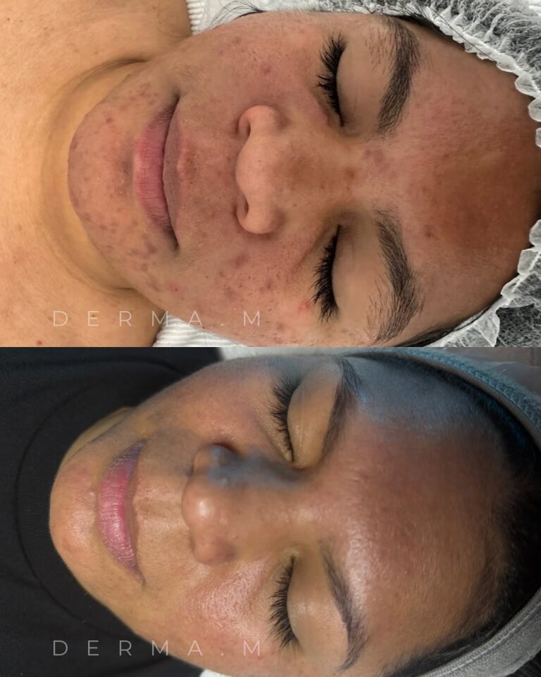 486318970_18041955308607504_5807586981656515035_n