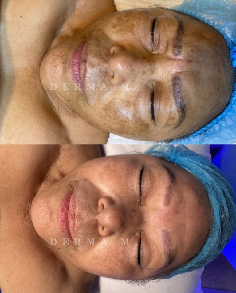 500520229_18048439613607504_5822170141366599941_n