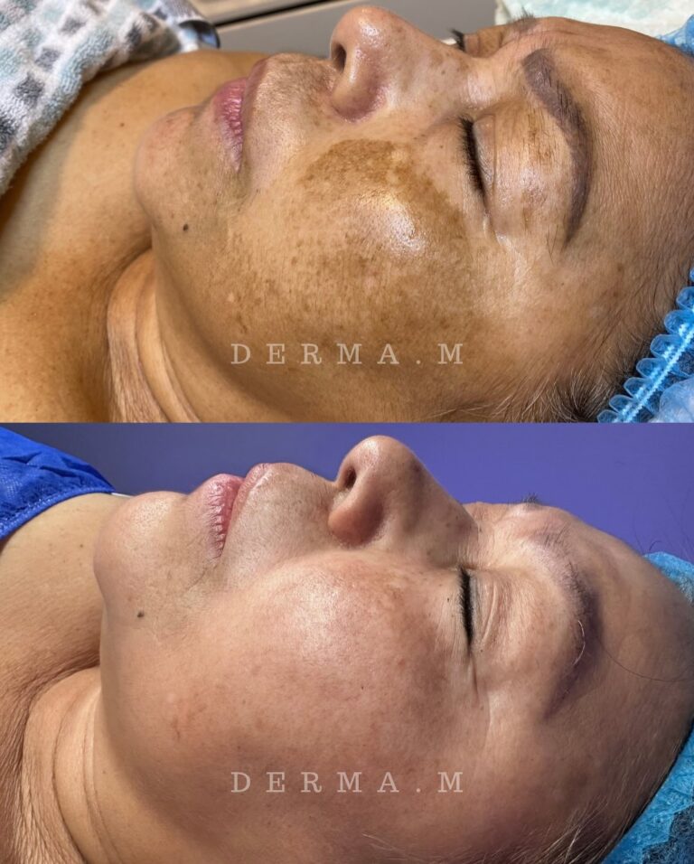 500934839_18048439631607504_1726943668951929403_n