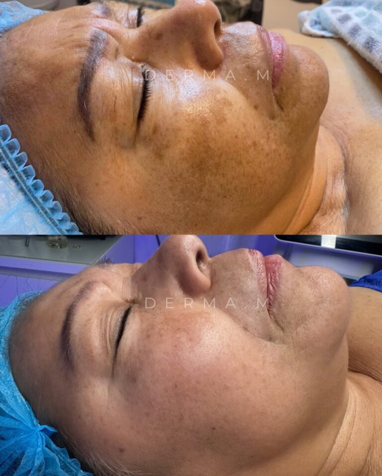 501401342_18048439622607504_4895503987179619085_n